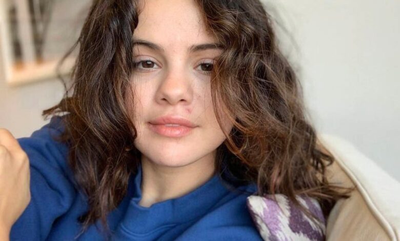 Selena Gomez posted a photo without makeup. The star shocked her fans with unedited photos.